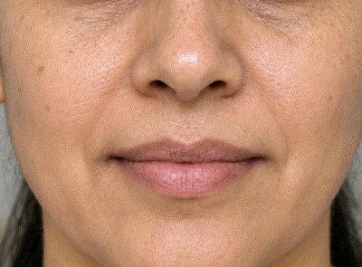Close-up of skin texture and fine lines around the mouth